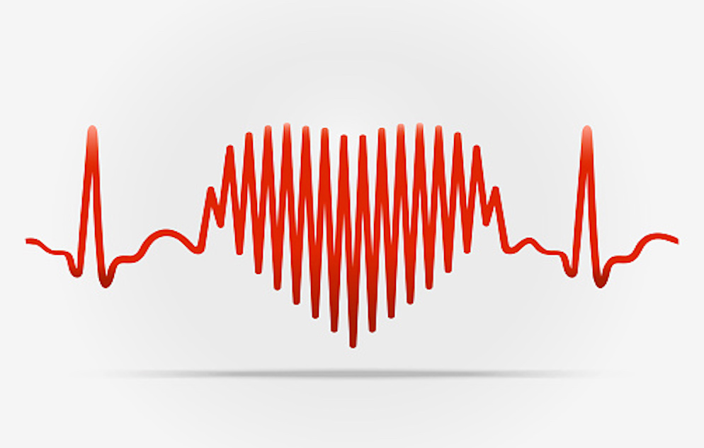 EKG of heart beat, with part of the EKG forming the shape of a heart