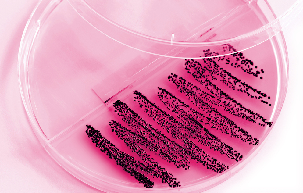 Petri dish