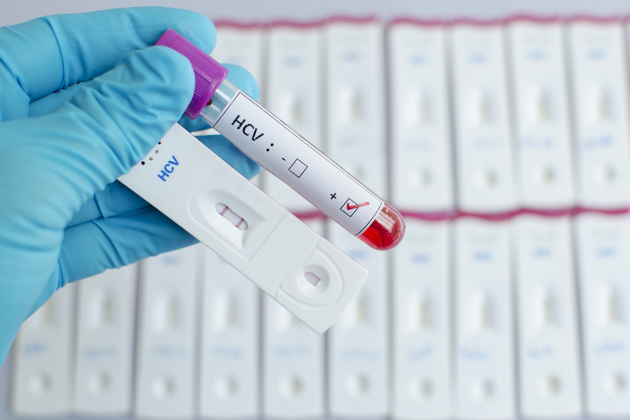 Hepatitis C virus (HCV) testing positive