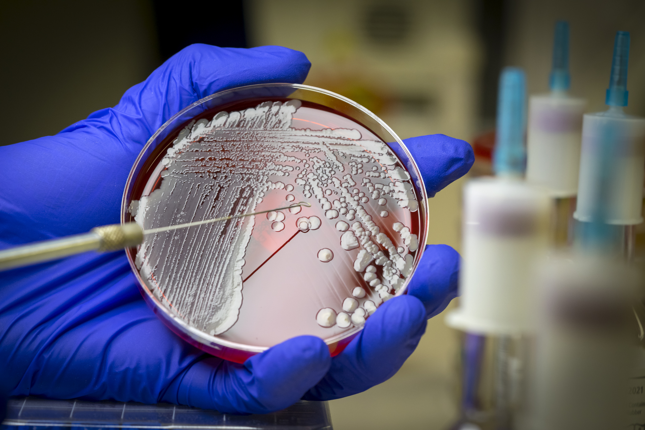 Microbiologist examining an MRSA bacteria on blood agar plate