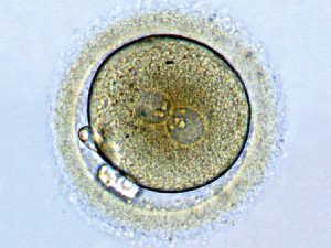 Opinion: What happens when the rights of the “fertilized egg” supersede the rights of the mother