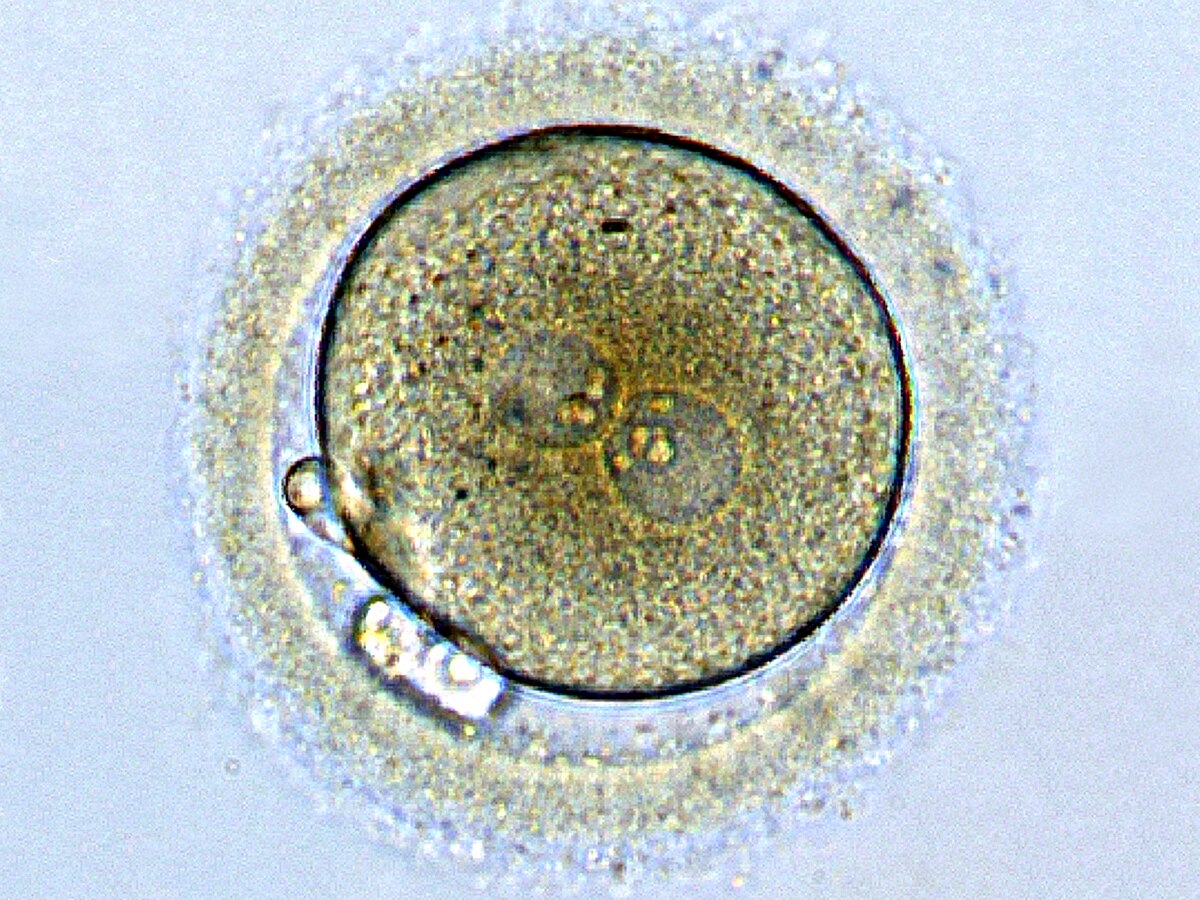 A human zygote. A first day of development. Both male and female pronuclei, a polar body are clearly visible.